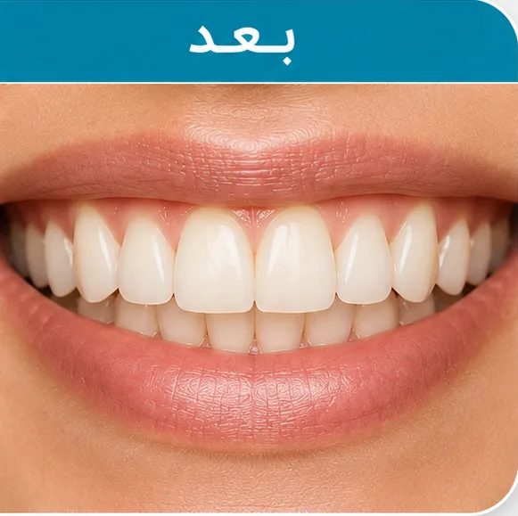 بعد