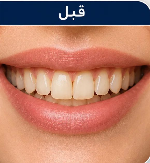 قبل