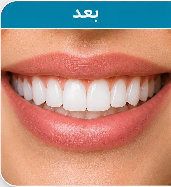 بعد